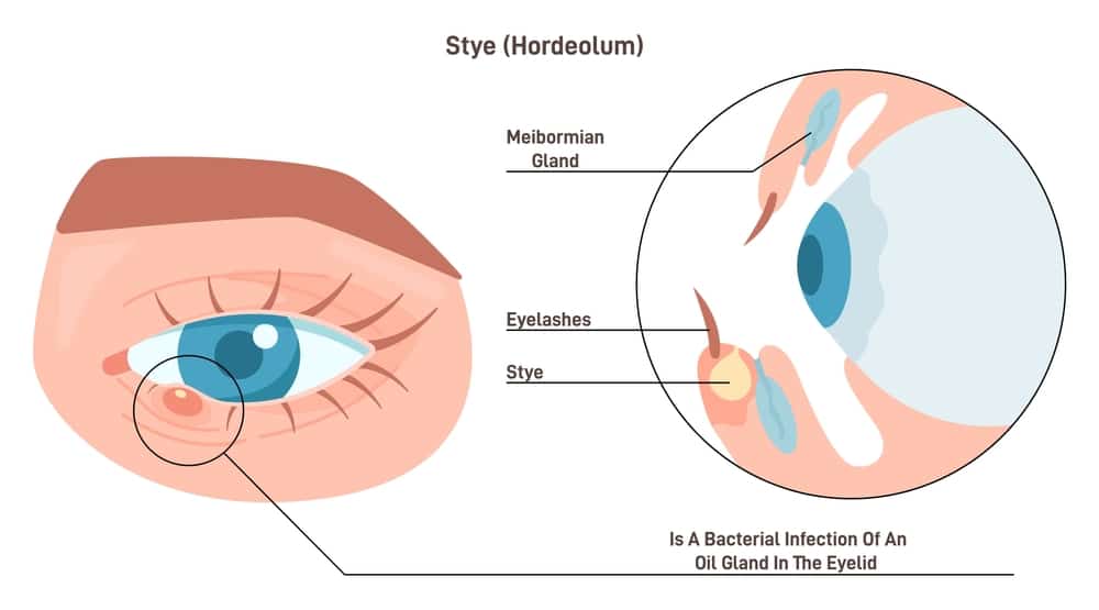eye oinments for stye